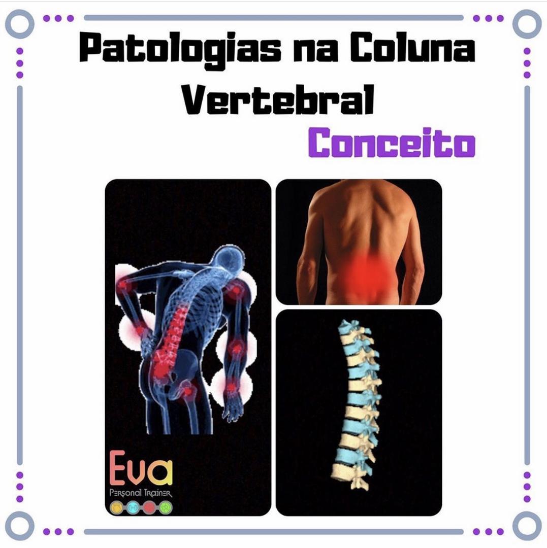 Patologias na Coluna Cervical - Conceito